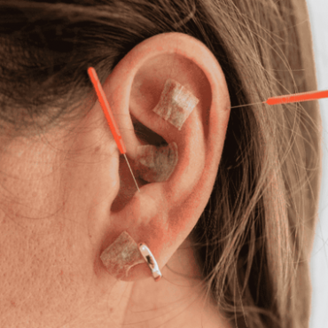 Auriculoterapia em Águas Claras