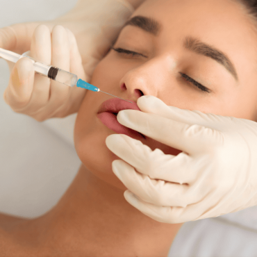 Preenchimento Labial em Águas Claras