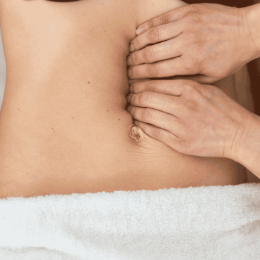Tratamento para Diástase em Águas Claras