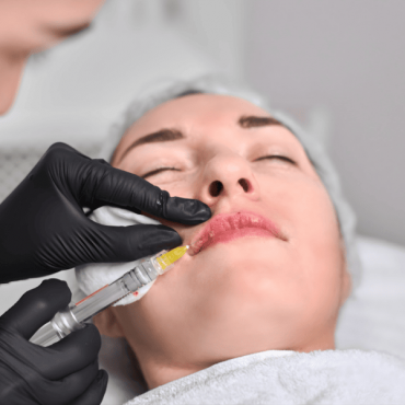 Preenchimento Bigode Chinês em Águas Claras
