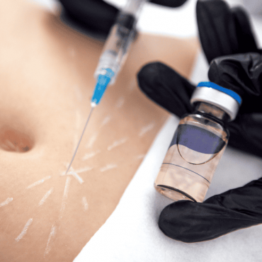 Lipo Injection (Enzimas Redutoras) em Águas Claras